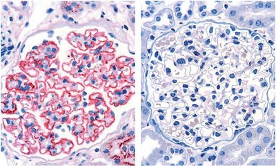 Immunhistochemie (IgG1-Färbung) renaler Gewebeproben