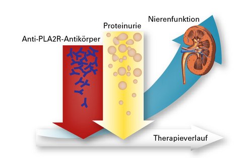 Zusammenhang zwischen Anti-PLA2R-Antikörpern, Proteinurie und Nierenfunktion im Verlauf einer Therapie