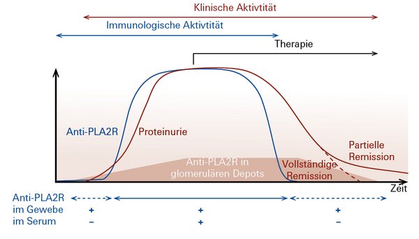 Abgeänderte Abbildung aus: Francis et al., Am J Kidney Dis 68, 138-47 (2016)