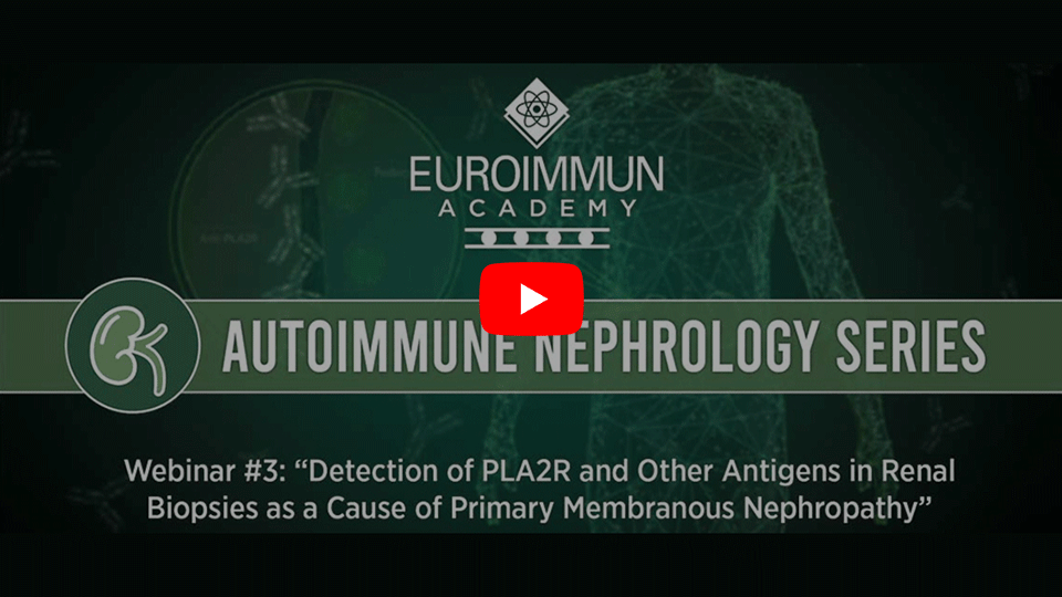 Autoimmunnephrologie-Webinarreihe Folge 3